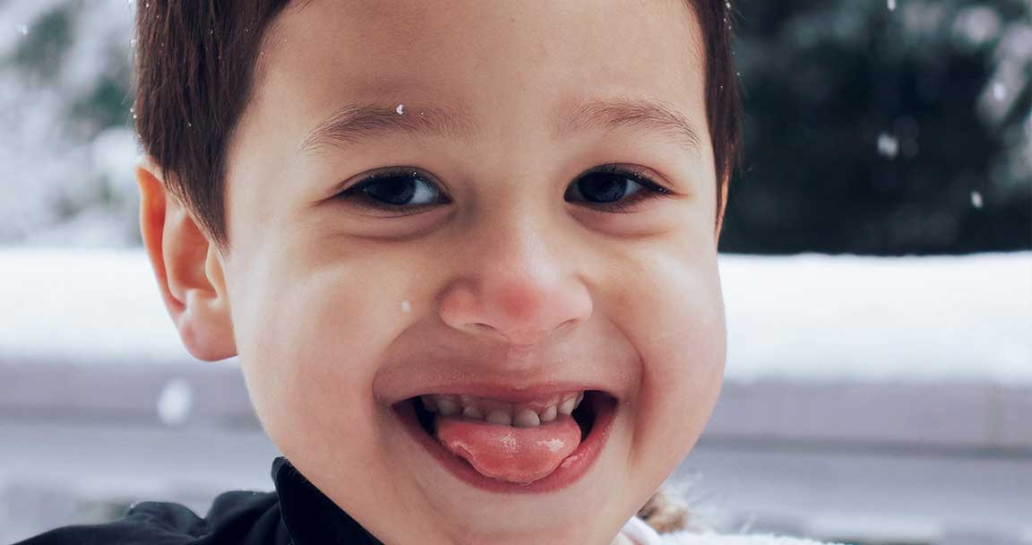 Tongue Thrust in Children