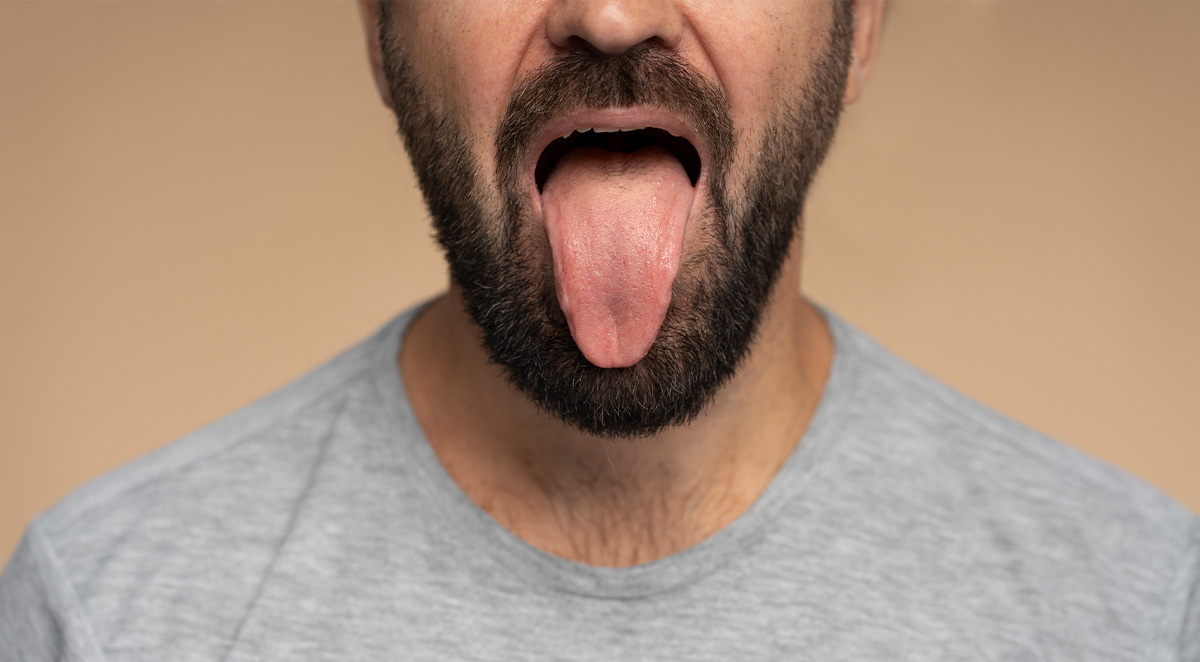 when tongue thrust does not self correct
