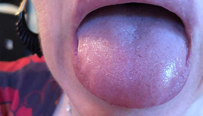 11 Signs Your Tongue is Too Big For Your Mouth